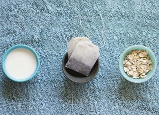 Sunburn Relief at home