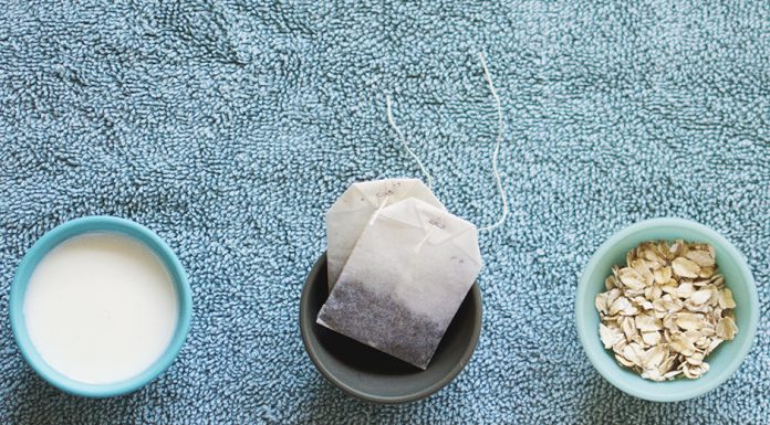 Sunburn Relief at home